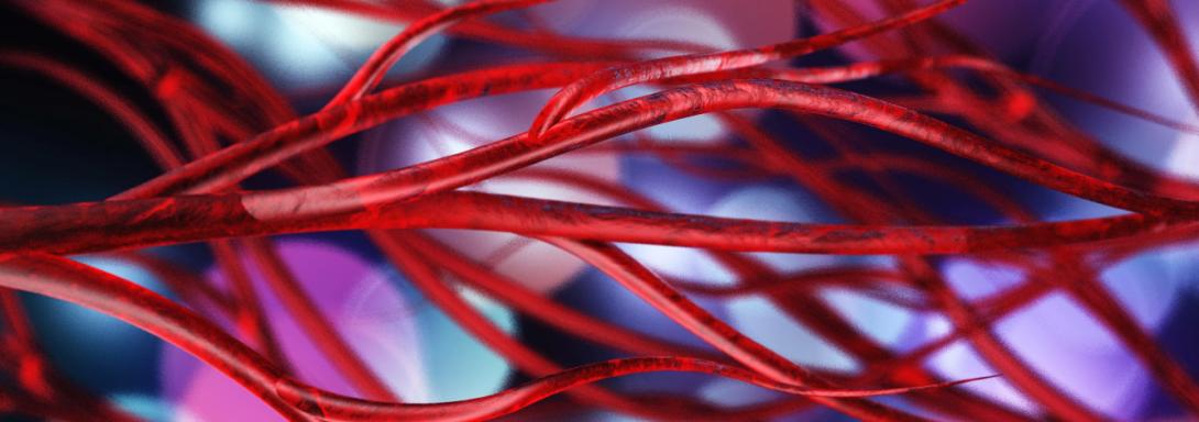 Varices pelviennes